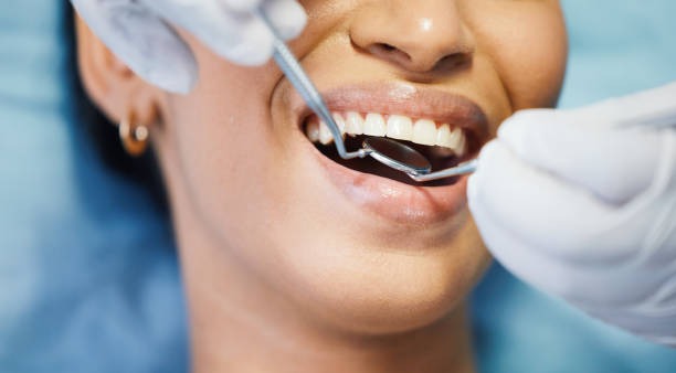 Best Emergency Cosmetic Dentistry (e.g., broken veneers) in Coronado, CA