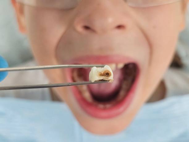 Best Emergency Pediatric Dental Care in Coronado, CA